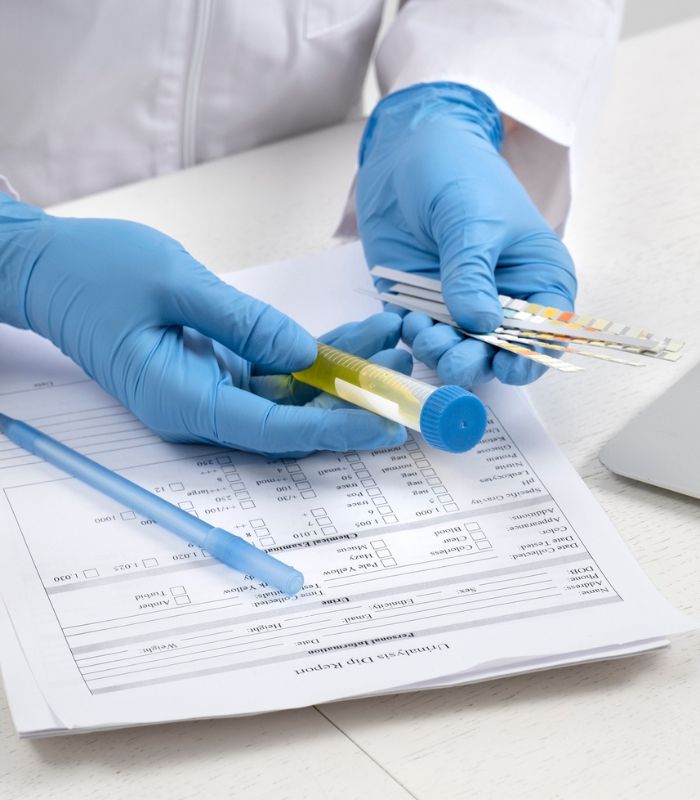 Lab Test at Home